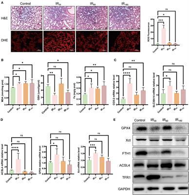 Ischemia/reperfusion-activated ferroptosis in the early stage triggers excessive inflammation to aggregate lung injury in rats
